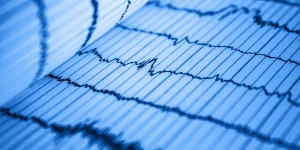 Beitragsbild des Blogbeitrags Smartwatch – So funktioniert EKG und Blutdruckmessung