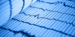 Beitragsbild des Blogbeitrags Die besten Smartwatches mit Blutdruckmessung und EKG