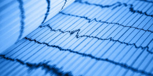 Beitragsbild des Blogbeitrags Die besten Smartwatches mit Blutdruckmessung und EKG