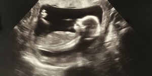 Beitragsbild des Blogbeitrags Schwangerschaft – die ersten 3 Monate WERBUNG 
