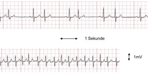 Beitragsbild des Blogbeitrags EKG zu Hause messen?