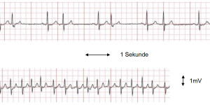 Beitragsbild des Blogbeitrags EKG zu Hause messen? 