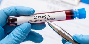 Beitragsbild des Blogbeitrags Coronavirus: erstmals mehr Genesene als Erkrankte in NÖ 