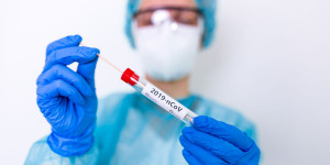 Beitragsbild des Blogbeitrags Corona: Südafrika-Mutation auch in Niederösterreich aufgetreten