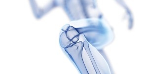 Beitragsbild des Blogbeitrags Arthrose Programm GL:D kommt nach Österreich 