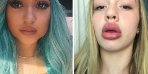Beitragsbild des Blogbeitrags #KylieJennerChallenge: Riskanter Internet-Hype um XXL-Lippen