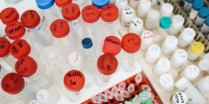 Beitragsbild des Blogbeitrags Corona-Testkapazitäten werden zum Problem in der 24-Stunden-Betreuung