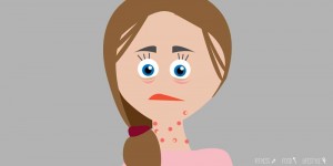Beitragsbild des Blogbeitrags Pickel am Hals – was hilft wirklich gegen unreine Haut?