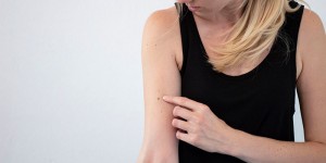 Beitragsbild des Blogbeitrags Wie entstehen Muttermale? Alles rund um das Muttermal 