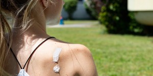 Beitragsbild des Blogbeitrags So kannst du einer Sonnenallergie vorbeugen