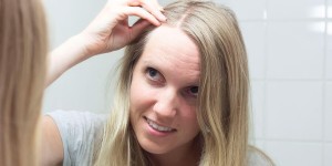 Beitragsbild des Blogbeitrags 16 Hausmittel gegen Schuppen – Diese helfen wirklich!