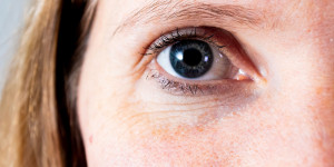 Beitragsbild des Blogbeitrags Omg! Das sind die Ursachen für Augenringe!
