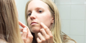 Beitragsbild des Blogbeitrags Hausmittel gegen Mitesser: 13 effektive Wunderwaffen bei verstopften Poren 