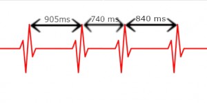 Beitragsbild des Blogbeitrags Was ist eine HRV-Messung, wofür ist sie gut?