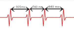 Beitragsbild des Blogbeitrags Was ist eine HRV-Messung, wofür ist sie gut? 