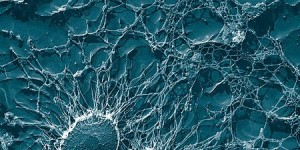 Beitragsbild des Blogbeitrags Armstrong Economics: Medizinverschwörung - die Regierung ändert Sterbeurkunden um die Existenz superresistenter Bakterien zu verbergen 