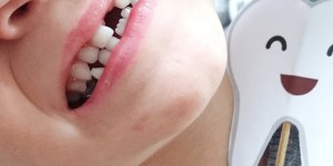 Beitragsbild des Blogbeitrags OH EIN WACKELZAHN - ZAHNWECHSEL BEI KLEINKINDERN