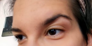 Beitragsbild des Blogbeitrags Unverhofft kommt oft – Wenn die Allergie gegen Bienengift grüßen lässt
