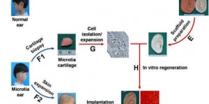 Beitragsbild des Blogbeitrags Researchers 3D Bioprint the First Ears Made From Childen’s Own Cells 