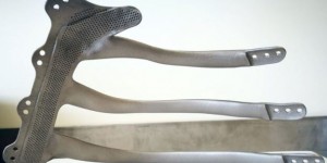 Beitragsbild des Blogbeitrags Surgeons use 3D Printed Titanium Implant to Rebuilt Man’s Breastbone and Ribs