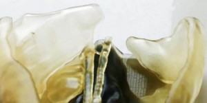 Beitragsbild des Blogbeitrags 3D Printing Saves Toddler’s Life with Kidney Transplant