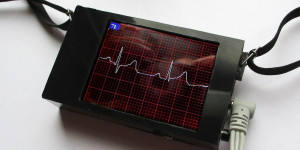 Beitragsbild des Blogbeitrags An Arduino ECG device with an integrated display 