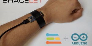 Beitragsbild des Blogbeitrags Epilet is a tinyML-powered bracelet for detecting epileptic seizures