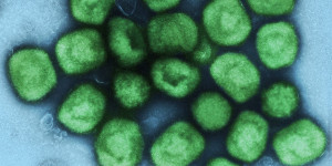 Beitragsbild des Blogbeitrags Verteilung von Affenpocken-Impfstoff: Wurde die Kühlkette nicht eingehalten?