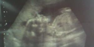 Beitragsbild des Blogbeitrags Als meine Eltern mir sagten, dass ich schwanger bin 