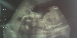 Beitragsbild des Blogbeitrags Als meine Eltern mir sagten, dass ich schwanger bin