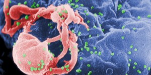 Beitragsbild des Blogbeitrags #88 Gentherapie: Spezielles Enzym entfernt HIV-Gene aus infizierten Zellen 