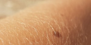 Beitragsbild des Blogbeitrags #172 Fortschritte bei Forschung zur Regeneration menschlicher Haut