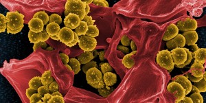 Beitragsbild des Blogbeitrags #289 Dank körpereigenem Molekül Atemwegstherapien effizienter