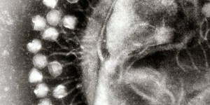 Beitragsbild des Blogbeitrags #298 Mögliche Lösung zur Bekämpfung von Antibiotikaresistenz