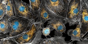 Beitragsbild des Blogbeitrags #345 Gesunde Mitochondrien gegen Alzheimer