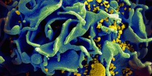 Beitragsbild des Blogbeitrags #355 HIV-Impfstoff: Neuer Ansatz ohne Tierversuche