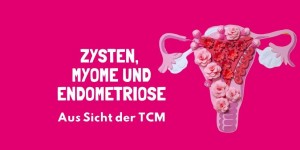 Beitragsbild des Blogbeitrags PODCAST | Zysten, Myome und Endometriose – Teil 1 von 2 