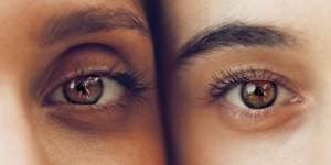Beitragsbild des Blogbeitrags Mit verjüngtem Blick durch den Tag: Wie eine Augenlidstraffung für mehr Wohlbefinden sorgt