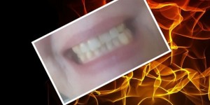 Beitragsbild des Blogbeitrags Lass dein Kiefer locker, es kann nichts dafür!