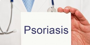 Beitragsbild des Blogbeitrags Psoriasis: Symptome, Auslöser und Behandlung 