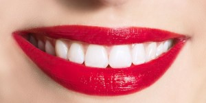 Beitragsbild des Blogbeitrags Wie bekommt man weiße Zähne? Alles über Bleaching!