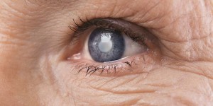 Beitragsbild des Blogbeitrags Grüner Star: lange symptomlos, doch folgenschwer