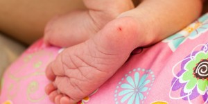 Beitragsbild des Blogbeitrags Phenylketonurie: Häufigkeit, Symptome & empfohlene Diät