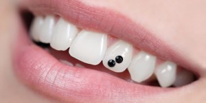 Beitragsbild des Blogbeitrags Zahnschmuck: Welche Art ist die beste?
