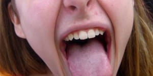 Beitragsbild des Blogbeitrags Zungendiagnostik – das verrät die Zunge über deine Gesundheit 