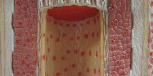 Beitragsbild des Blogbeitrags Arteriosklerose – Anzeichen, Ursachen und Therapie