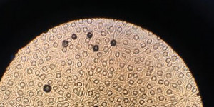 Beitragsbild des Blogbeitrags :: Bio-Challenge oder der steinige Weg zum „Olymp“