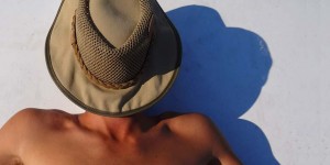 Beitragsbild des Blogbeitrags Sommer, Sonne, Sonnenbrand – Tipps, die bei zu viel Sonne helfen