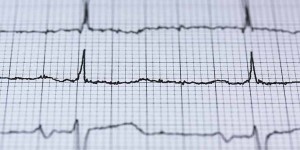 Beitragsbild des Blogbeitrags Vorhofflimmern: Unterversorgung in Ö gefährdet Herzgesundheit