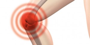 Beitragsbild des Blogbeitrags Arthrose – neues, innovatives Medikament gegen Schmerzen in Sicht 